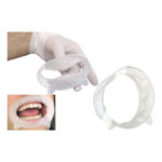 OptraGate – دهان بازکن اپتراگیت